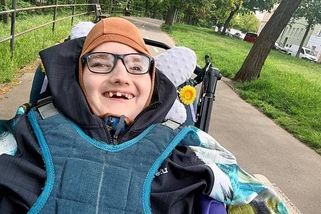 Míša z Ústí trpí těžkým postižením. Opatrovníkům docházejí síly, prosí o pomoc